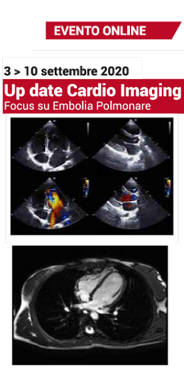 Up date Cardio Imaging Focus su embolia polmonare
